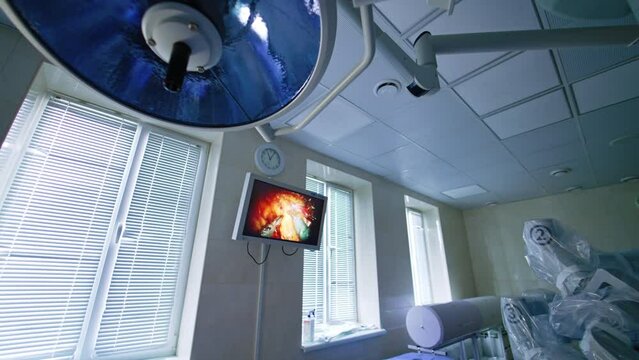 Metal forceps work with the live tissue on the monitor hanging on the wall. Screen showing the pwork of Da Vinci surgeon's manipulators.