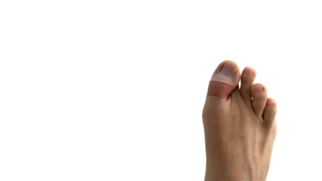 pain foot disease with bandage toenail isolated on transparent background space for text 