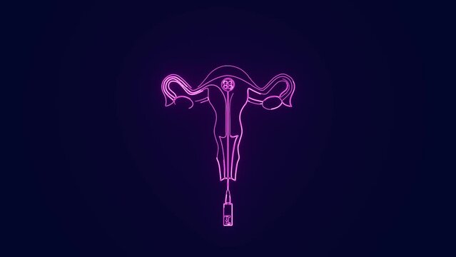 Female IVF treatment reproduction for pregnancy medical science animation