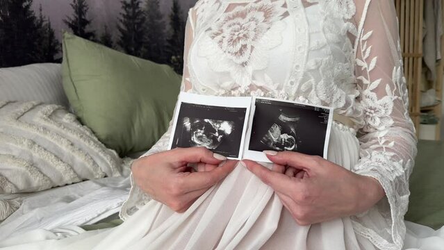 belly of a pregnant girl in a white dress . ultrasound pictures of the baby in his hands. the concept of motherhood and pregnancy.