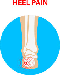 Heel pain. Human ankle joint icon back view. Vector illustration.