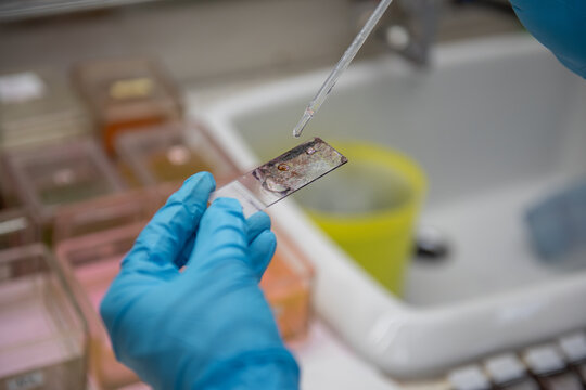 Medical scientists preparing cytology slides for pathologists to diagnose in hospital.