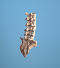 Lumbar spine fusion rods on blue background