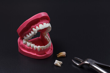 Stainless steel dental pliers and layout of the human jaw on the black background.