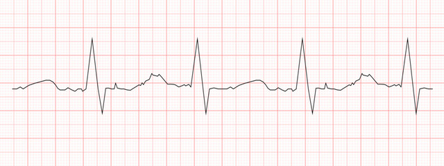 Fototapeta premium Black heart beat diagram printed on red graph paper. ECG chart. Cardiac rhythm line. Cardio test sign. Cardiology hospital symbol