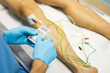 An unrecognizable physiotherapist is using the technique of electroacupuncture on a patient....