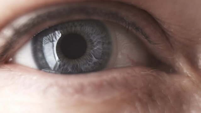 Macro. The right female eye is gray in the lens. The pupil constricts when exposed to light