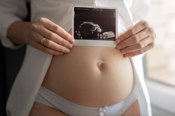 Pregnant woman holding ultrasound baby image. Close-up of pregnant belly and sonogram photo in...