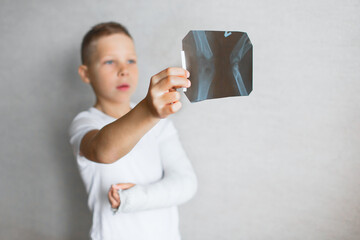 The boy with a broken hand looks at the X-ray. X-ray in the hands of a sad boy with a broken arm