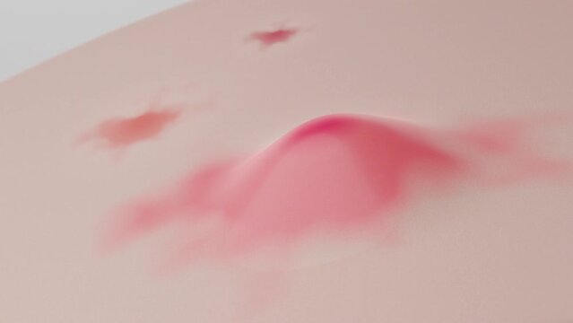 acne inflammation and Red spot scar on face skin 3D rendering.