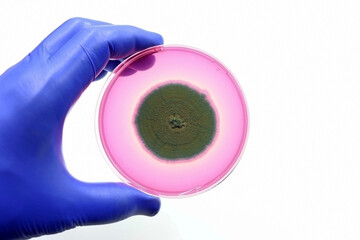 Fungus isolated in the Microbiology laboratory. Fungal infections by pathogenic fungi