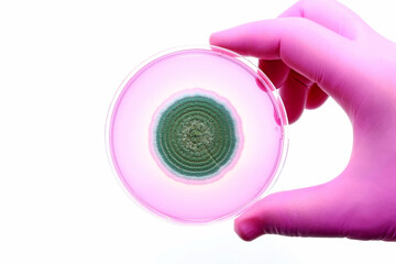 Pink glove with a microbiological culture of fungi.