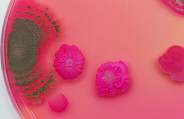 Colonies of fungi and bacteria in a Petri dish, at high magnification.