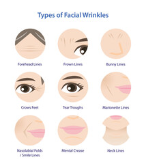 Types of facial wrinkles vector icon set. Icon set of Forehead, Bunny, Marionette, Frown lines, Mental crease, Crows feet, Tear troughs, Nasolabial folds, Smile and Neck lines.