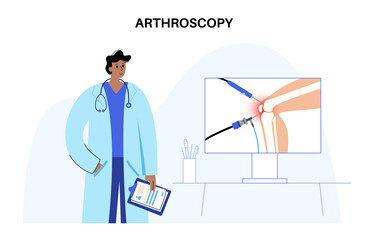 Knee joint arthroscopy