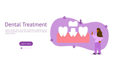 dental prosthetics illustration set. characters seen tooth wear crown to make the permanent tooth less damaged. dental crown treatment concept. vector illustration.
