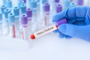 Doctor holding a test blood sample tube with Vibrio Cholerae test on the background of medical test tubes with analyzes.