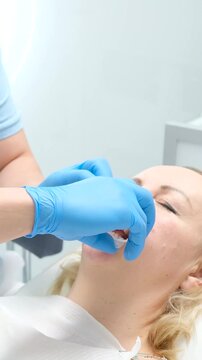 liquid cofferdam to isolate gums from action of bleaching agent optragat rotary spreader after end of dental procedure doctor removes mouth dilator takes glasses 