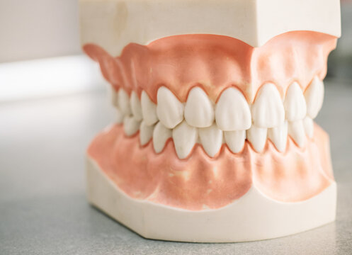 Mould of human teeth. Oral health concept. Mould of human teeth. Close up dental gypsum model. Plaster cast human jaws prothetic laboratory. Oral health concept