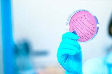 Laboratory workers hold culture plates with bacteria or viruses growing on media in experiment...