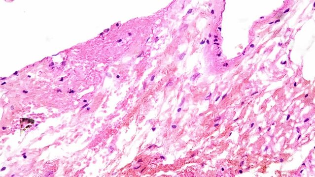 Section of adrenal gland of human being filmed under microscope 400x on bright field. Macro view of man organ showing different layers of cells. Producing steroid hormones. Healthcare and anatomy