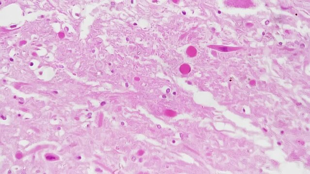 Section of human medulla oblongata filmed under microscope 400x on bright field. Macro footage of lower part of the brainstem magnified in scientific laboratory. Studying anatomy on biology lesson