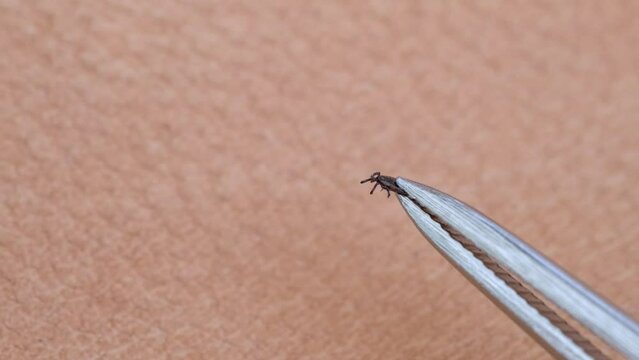parasitiform tick Ixodidae, blood-sucking parasites in tweezers, Acariformes, carrier of dangerous disease encephalitis, illness symptoms, tick-borne disease prevention strategies, research studies