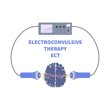 Electroconvulsive therapy for severe depression and schizophrenia treatment. ECT electrodes placement. Brain stimulation equipment for bipolar and major depressive disorders. Vector illustration.