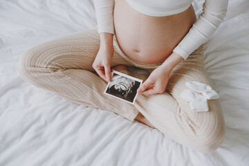 Cropped young pregnant woman wear white pyjamas hold in hand picture of ultrasound examination rest spend time in bedroom lounge home in own room hotel. Maternity family pregnancy expectation concept - obrazy, fototapety, plakaty