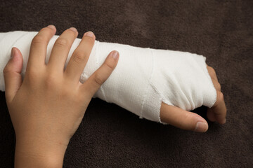 Image of a broken, bruised, or sprained arm that is immobilized. - obrazy, fototapety, plakaty