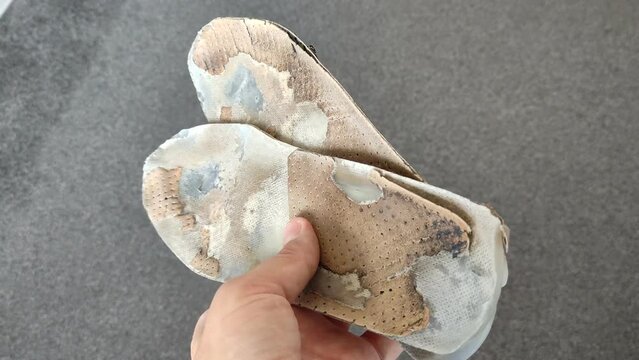 Man holds old worn out orthopedic insoles in his hand