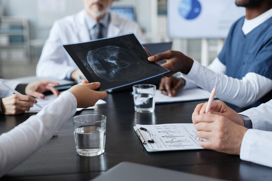 Hand of young black man in blue uniform passing x-ray image of patient scalp to colleague during working meeting or seminar of radiologists