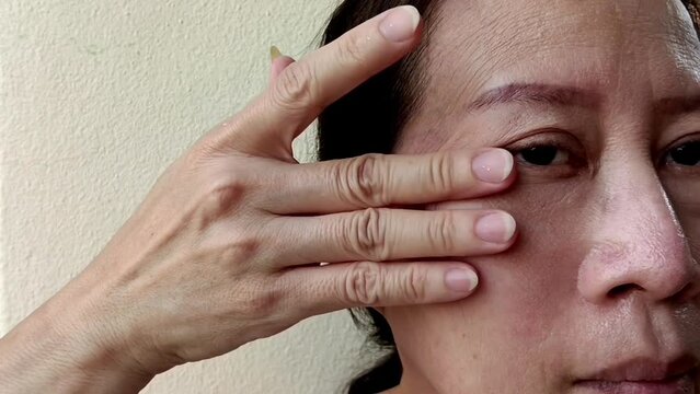 Middle-aged women have wrinkles on their faces, acne, freckles, scars on their faces.
