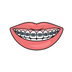 Dental braces on teeth smile schematic diagram raster illustration. Medical science educational illustration