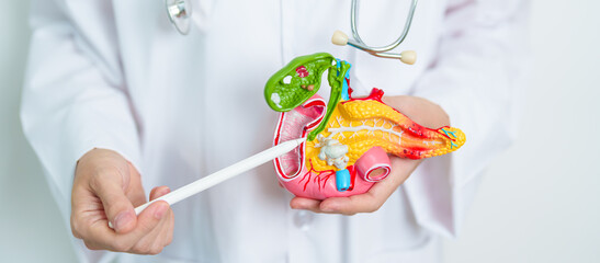 Doctor with human Pancreatitis anatomy model with Pancreas, Gallbladder, Bile Duct, Duodenum, Small intestine. Pancreatic cancer, Acute and Chronic pancreatitis,  Digestive system and Health concept