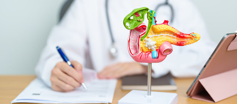 Doctor with human Pancreatitis anatomy model with Pancreas, Gallbladder, Bile Duct, Duodenum, Small intestine and tablet. Pancreatic cancer, acute pancreatitis and Digestive system