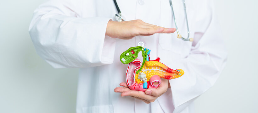 Doctor with human Pancreatitis anatomy model with Pancreas, Gallbladder, Bile Duct, Duodenum, Small intestine. Pancreatic cancer, Acute and Chronic pancreatitis,  Digestive system and Health concept