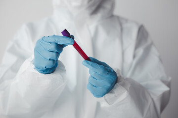 Laboratory is used for scientific research to examine and research blood obtained by sampling of...