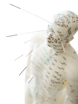 Male acupuncture model with needles in the head and body with isolated on transparent background, Traditional Chinese Medicine