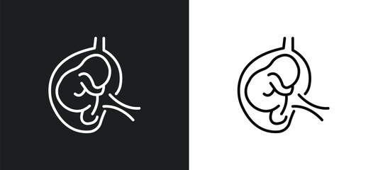 fetus in an uterus line icon in white and black colors. fetus in an uterus flat vector icon from fetus an uterus collection for web, mobile apps and ui.