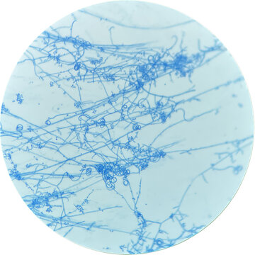 Trichophyton mentagrophytes with microconidia and spiral hyphae.