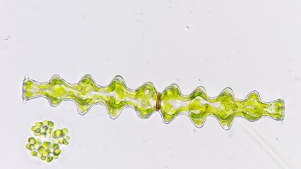 A unique shape freshwater microalgae, Pleurotaenium nodosum. Live cell. 40x objective lens. Stacked...