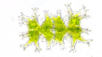 Vegetative reproduction of Staurastrum. Live cell. Selective focus image
