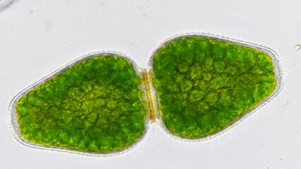 Freshwater green algae or phytoplankton, Pleurotaenium ovatum. Live cell. 40x objective lens....