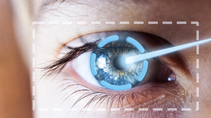 Close Up Blue Eye Laser Surgery