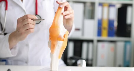 Doctor shows model of human artificial knee joint in medical office. Diseases of knee joints and ligaments