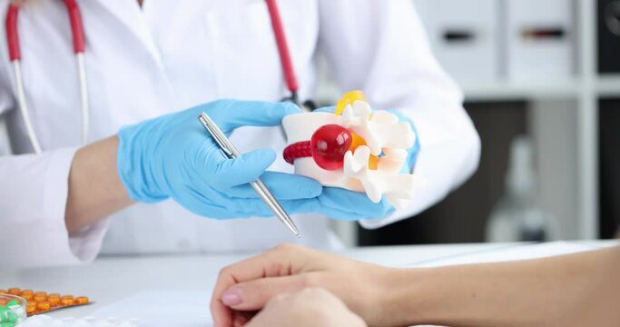 Doctor pointing to the inflammation of back artificial disc herniation model. Treatment of intervertebral hernia concept