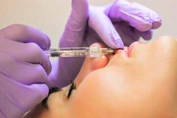Cosmetic procedure. Process of lip augmentation for a woman. A cosmetologist is wearing purple...