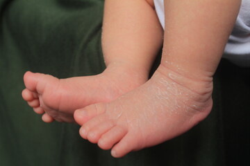 Newborn baby feet with soft, white and smooth skin texture
