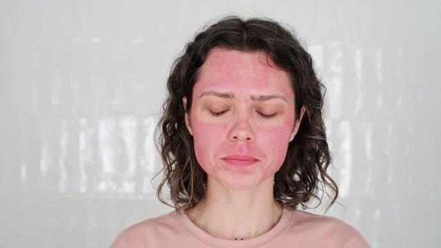 Sad young Woman Looking Disappointed Examines Red Blotches on Face Resulting from Unprofessional Skincare Treatment Failed Peel Allergic Reaction. Emotional Turmoil Caused by Appearance Imperfections